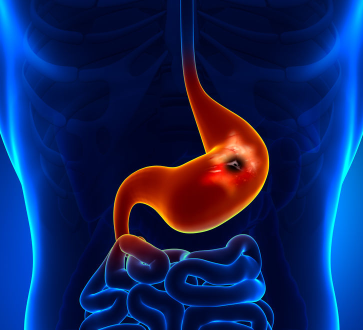 doenças oncológicas do aparelho digestivo