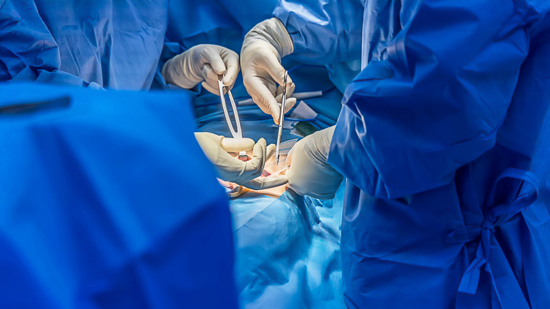 Doctor or surgeon did surgery of hernia mesh repair operation in